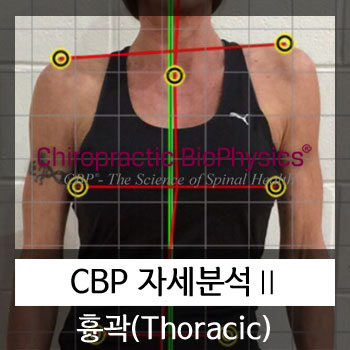 카이로프랙틱(CBP) 흉곽 자세분석