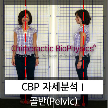  카이로프랙틱(CBP) 골반 자세분석