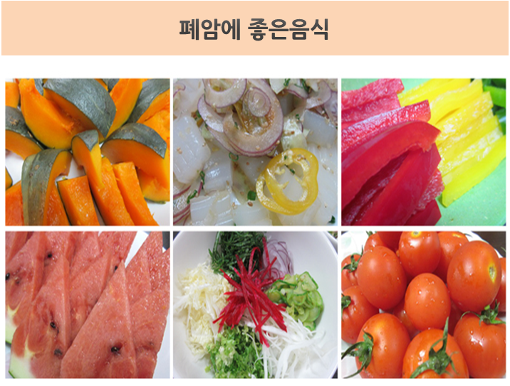 폐암에 좋은 음식 5가지