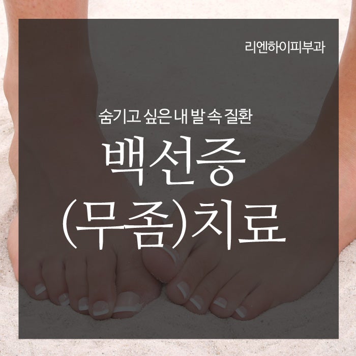부산무좀치료는 피부과전문의진료 '리엔하이'에서!