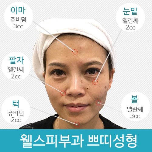 이마 엘란세 시술 만족도를 고려하여 시술합니다. 1