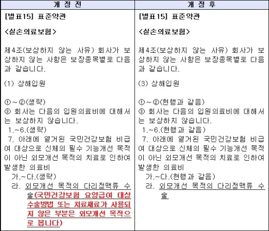 말 많던 하지정맥류 실손보험 표준약관 '수정완료' - 금감원 "치료 목적 여부 확인 위한 검사결과 제출 필요" 협조 요청 말 많던 하지정맥류 실손보험 표준약관 '수정완료' - 금감원 "치료 목적 여부 확인 위한 검사결과 제출 필요" 협조 요청