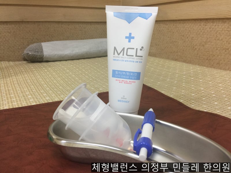 부항로션 사용하여, 부항 뜨는 치료 합니다 ^^ (의정부 민들레 한의원) : 네이버 블로그