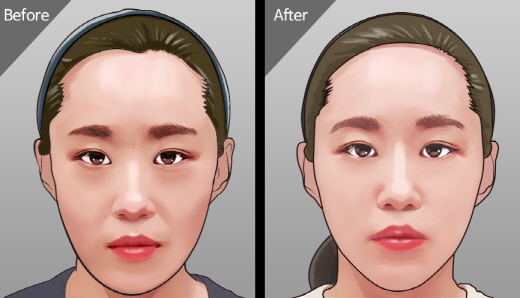  [의학 일러스트]_더마스터클리닉