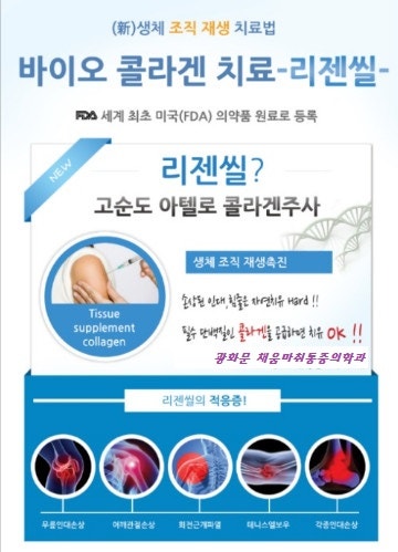 리젠실, 리젠씰, 바이오콜라겐 주사로 조직재생!!! / 광화문채움마취통증의학과, 광화문정형외과, 비수술치료, 광화문병원 : 네이버 블로그 리젠실, 리젠씰, 바이오콜라겐 주사로 조직재생!!! / 광화문채움마취통증의학과, 광화문정형외과, 비수술치료, 광화문병원 : 네이버 블로그