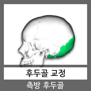  카이로프랙틱 AK 후두골 교정