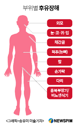 [단독]&nbsp;보험 장해등급분류 개정, 4월 실패...빨라야 3분기 - 2005년 이후 12년 만에 추진...속타는 보험업계