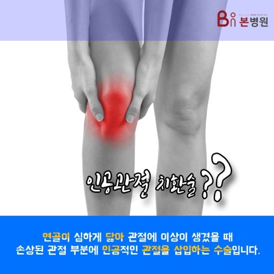  인공관절은 차원이 다른 이곳에서
