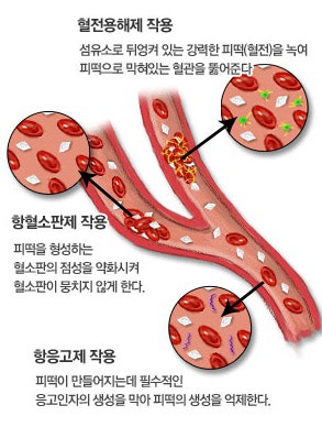 뇌경색의 전조, 초기 증상의 원인 치료 방법을 알아봅시다.