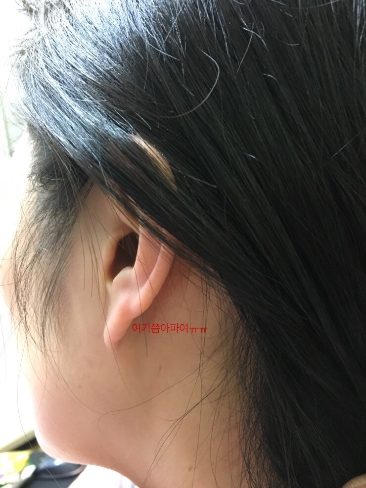 귀 뒤쪽 통증 찌릿 임파선 부었을때 증상이라니 : 네이버 블로그