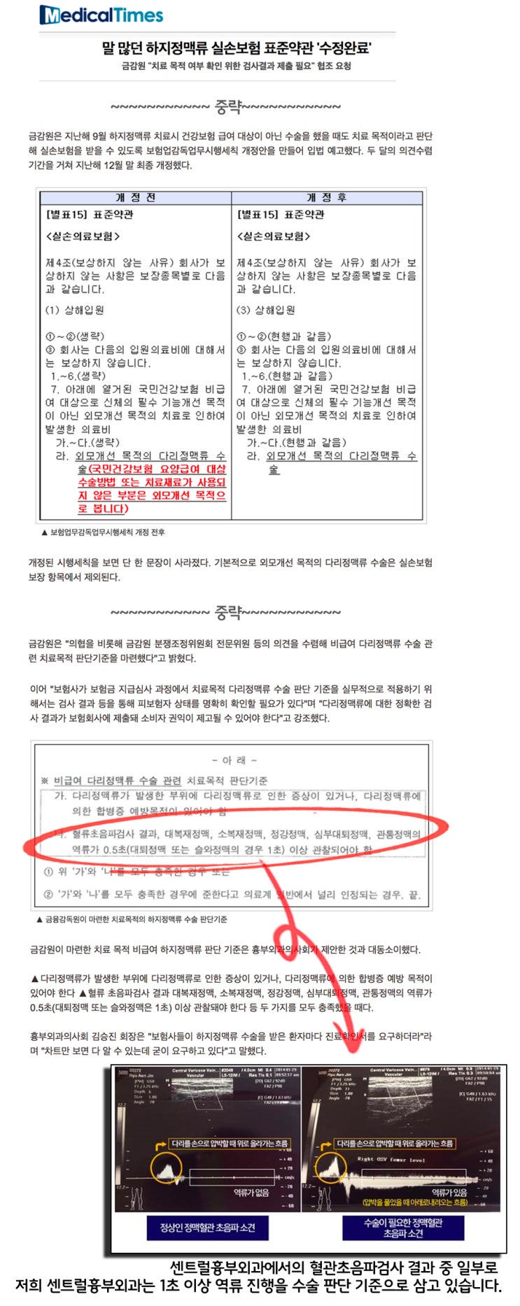  [메디컬타임스] 말 많던 하지정맥류 실손보험 표준약관 '수정완료'