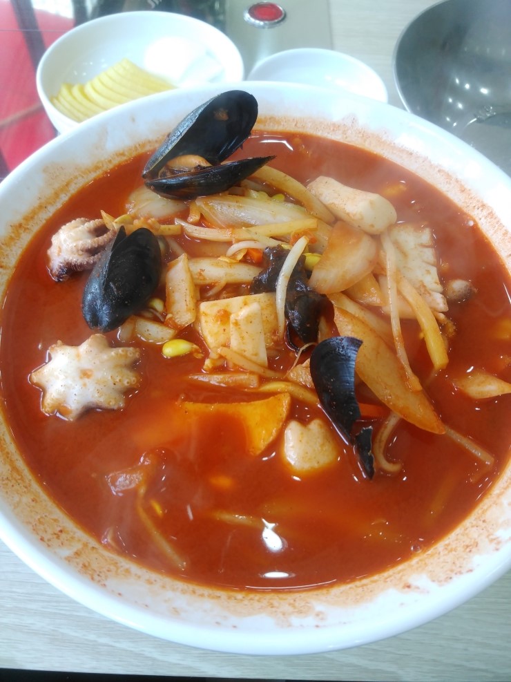  오랜만에 다시 다녀온 치과, 오복이란 없습니다.