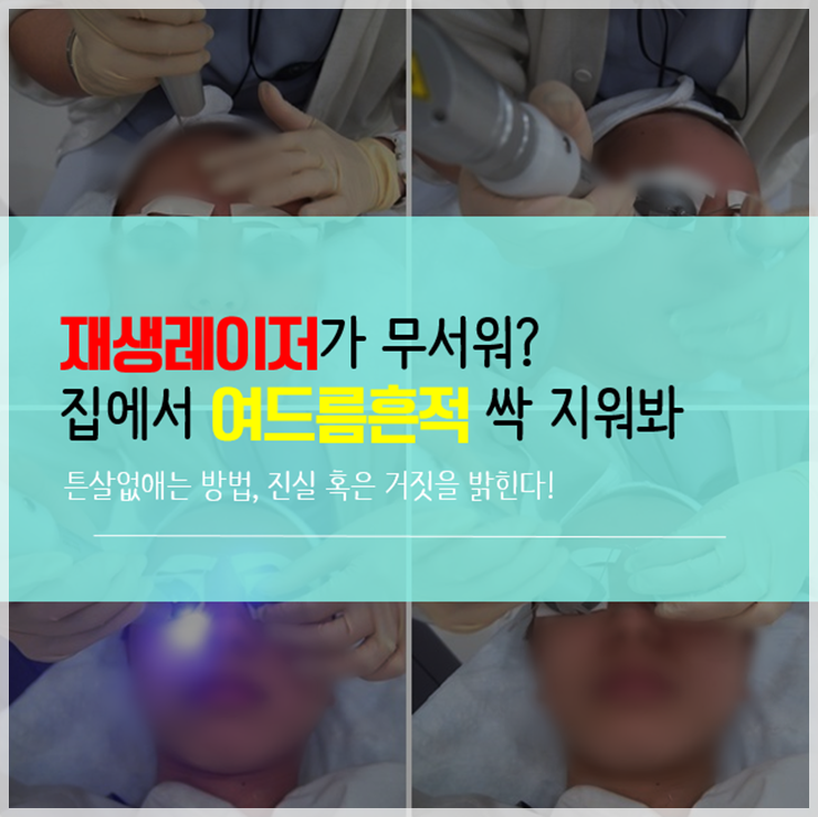  피부재생레이저가 여드름흉터치료 답은 아니죠