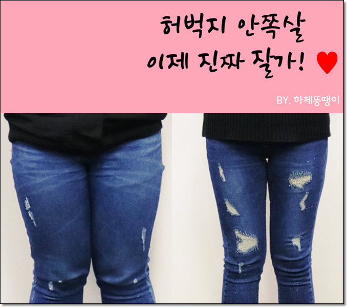  허벅지 안쪽살 때문에 허벅지지방분해주사가 생각난다면