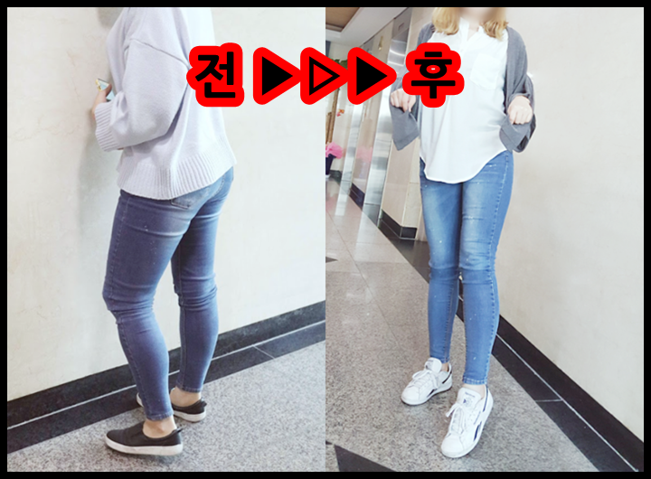  탄수화물 다이어트? 식단조절에 좋은 탄수화물 차단제!
