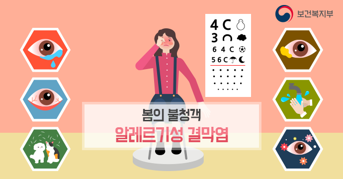 결막염을 미리 알고 대처해 봅시다. 5