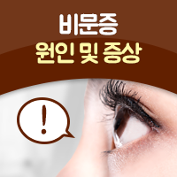 비문증, 눈 아지랑이, 비문증 원인과 비문증에 좋은 음식