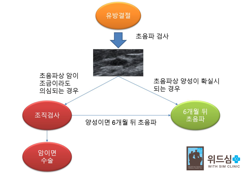 맘모톰수술 체험하기: 유방 맘모톰수술 4