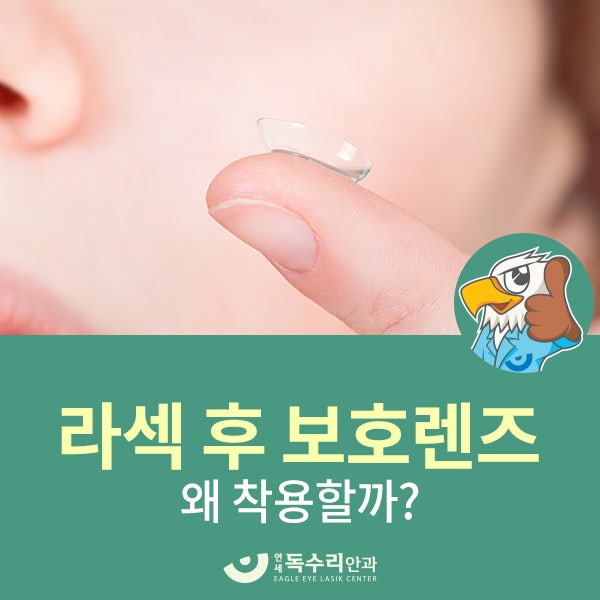 백현동안과 라섹후 보호렌즈 왜 착용할까? : 네이버 블로그 백현동안과 라섹후 보호렌즈 왜 착용할까? : 네이버 블로그