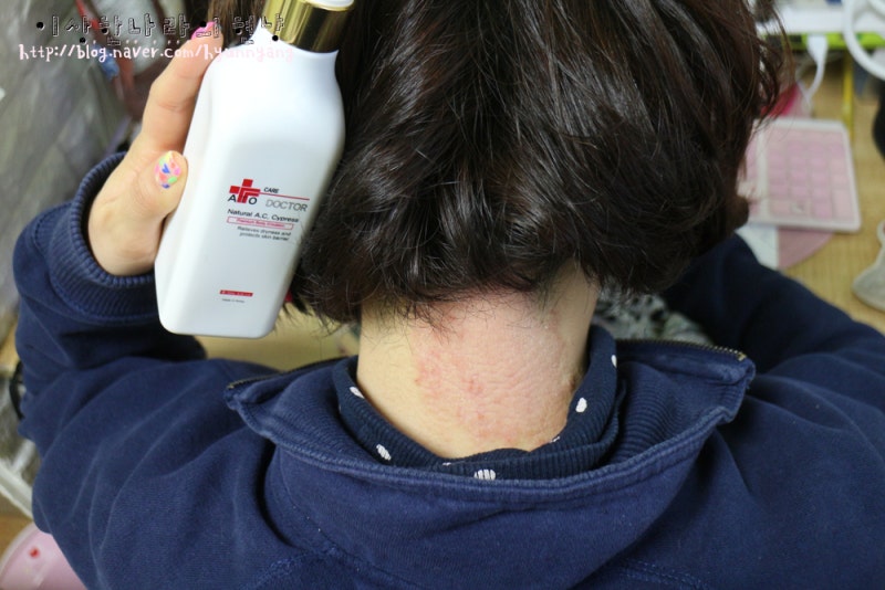 건선로션 아토피에 효과가 있는 로션 오어센아트로션 8