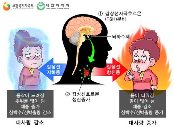 갑상선항진증(갑상선 기능 항진증)의 증상, 진단, 치료까지~! / 만화(웹툰)로 만나는 의학정보 <닥터단감의 의학이야기> EP.05