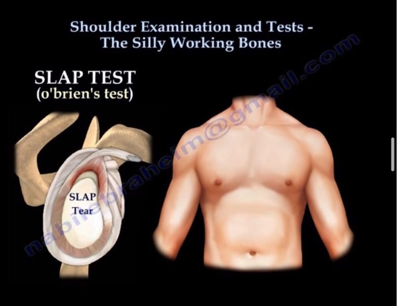 [근골격계] shoulder special test (speed, slap,empty, jerk) 간단정리 /100bod ...