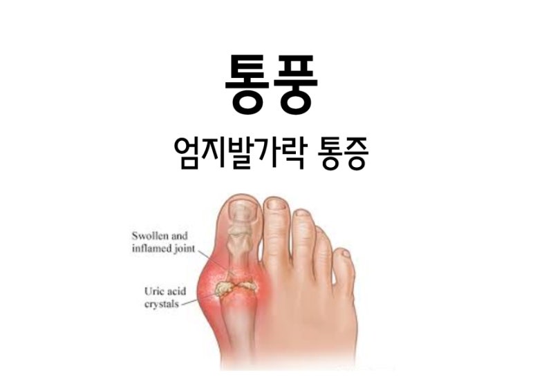 고통스러운 발가락: 원인, 증상 및 치료