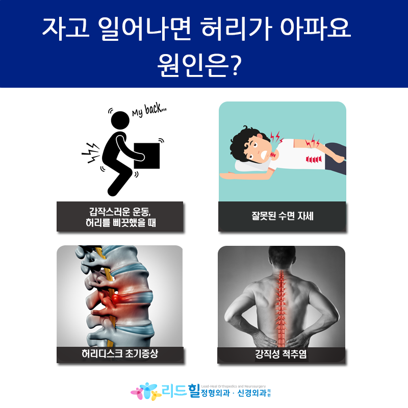 왼쪽 허리 통증 자고 일어나면 왜 허리가 아플까요?