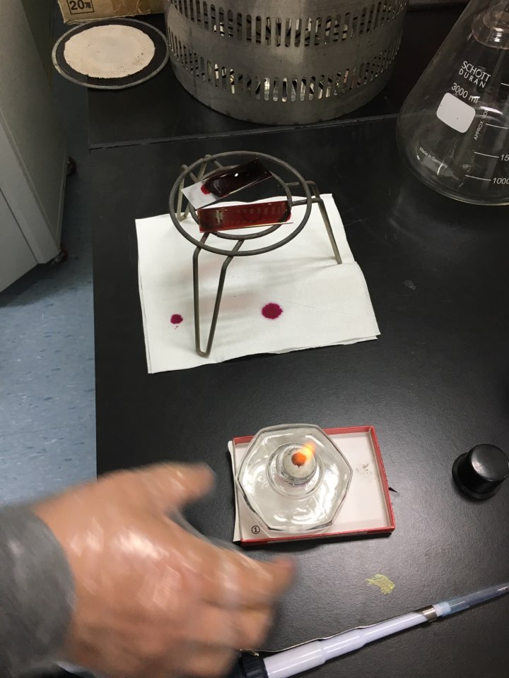  AFB stain