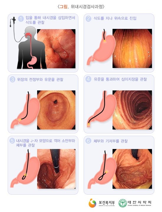 건강검진 일반내시경 체성분 스트레스 검사 건강검진 일반내시경 체성분 스트레스 검사