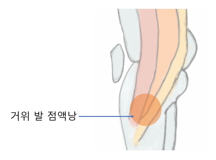 [문정역 한의원] 다시올 한의원 무릎통증 치료 내돈내산 6