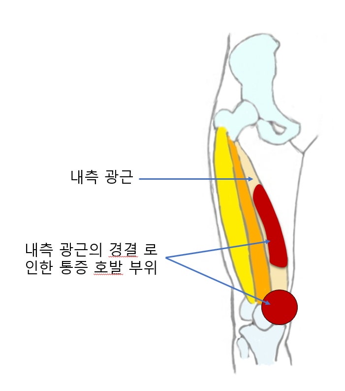 [문정역 한의원] 다시올 한의원 무릎통증 치료 내돈내산 8