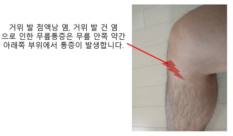 [문정역 한의원] 다시올 한의원 무릎통증 치료 내돈내산 9
