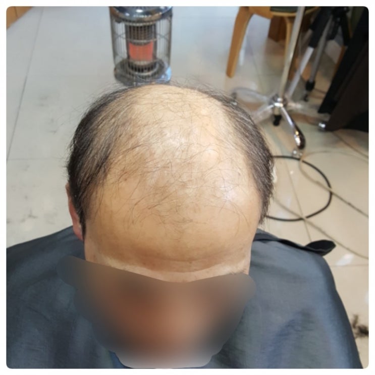  #김호증모가발#춘천가발#맞춤가발#남자가발#이은주헤어살롱에서 관리 참 잘해주네요~