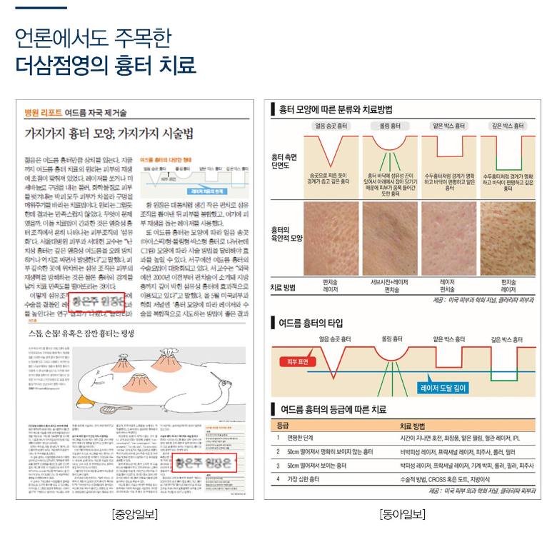 Rejuvenating acne scar change treatment review 2nd time 4
