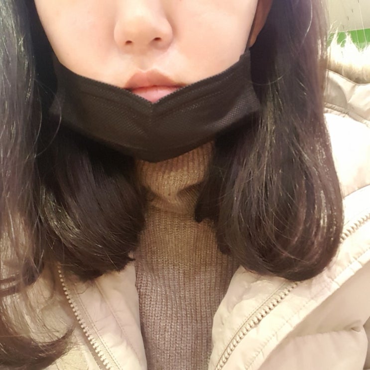  사랑니 발치 후기ㅠㅠ