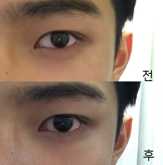 꿀팁 남자 잘생겨지는법 :: 눈망울을 바꿔 바! 사람들의 시선이 달라질 거야, : 네이버 블로그 꿀팁 남자 잘생겨지는법 :: 눈망울을 바꿔 바! 사람들의 시선이 달라질 거야, : 네이버 블로그