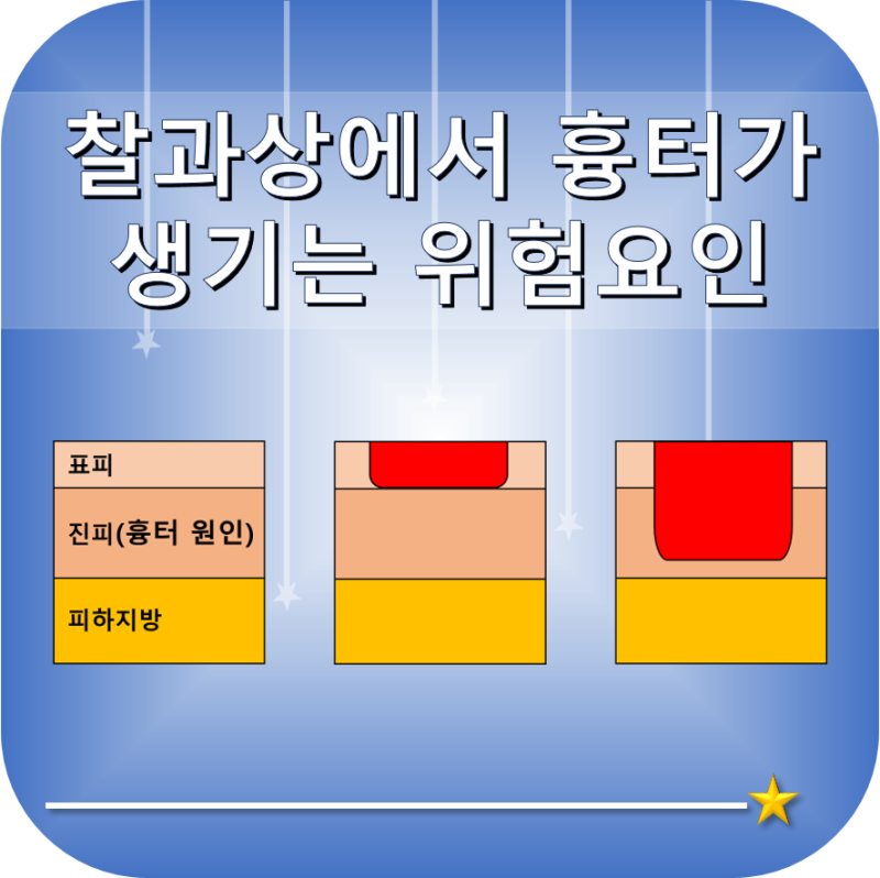 찰과상 후 심한 흉터가 남는 위험요인 : 네이버 블로그