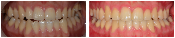 치아의 배열, 기능 그리고 미