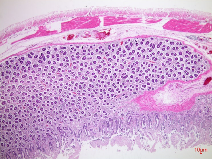  AFB stain-2