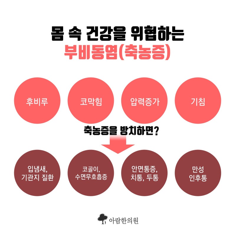 축농증 치료에 앞서 조사하는 어린이 축농증의 원인은?