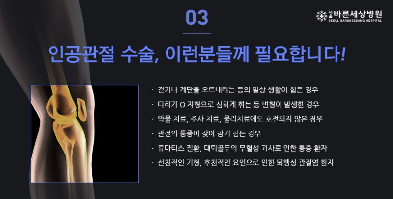 무릎 인공관절 수술의 성공률을 높이는 방법은? 3
