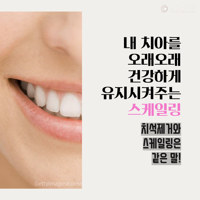 수원삼성전자중앙문치과 김기록치과 직장인 필수 치료 스케일링(치석제거)은 왜 해야 할까요?