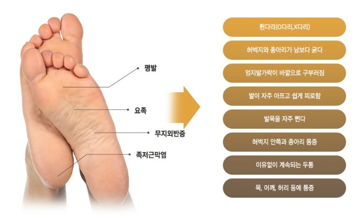 도촌동 정형외과 족부질환의 종류와 증상 및 예방법 4
