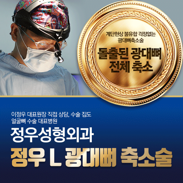  광대뼈축소술부작용 없이 계단현상 불유합 걱정없는 정.우.성.형.외.과