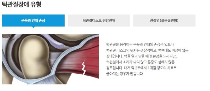 송도턱관절병원 턱이 아픈 이유 3