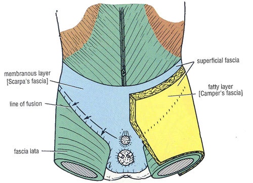 옆구리 지방흡입과 Scarpa's fascia : 네이버 블로그