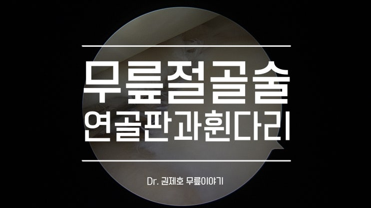  휜 다리로 인한 연골판 끊어짐에는 근위 경골 절골술
