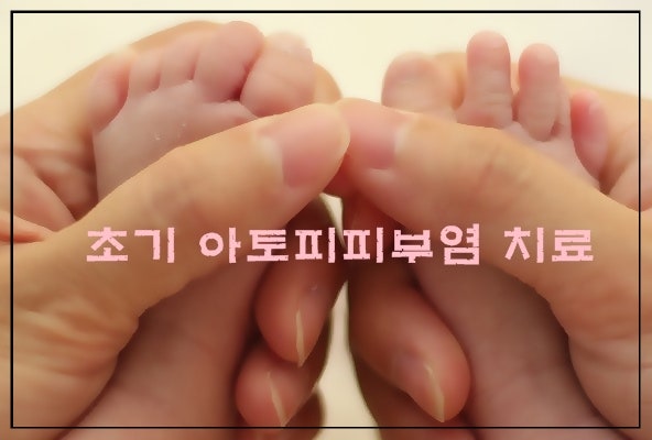 몸 가려움증 온몸이 간지러워요 손 발 12