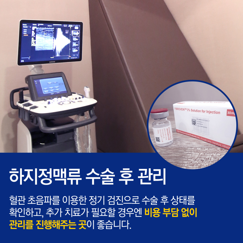 하지정맥류 수술 1개월 후/정기검진 초음파검사/하지정맥류 원인 및 치료방법